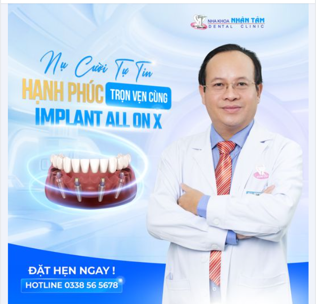 Nụ cười tự tin - Hạnh phúc trọn vẹn cùng Implant All On X