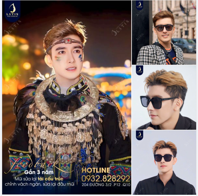 Nâng mũi nam đẹp "chấn động" như thế này luôn mà
