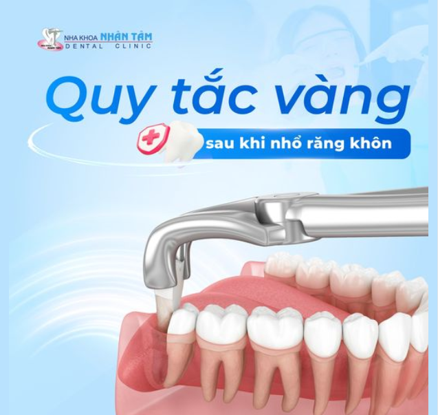 QUY TẮC VÀNG SAU KHI NHỔ RĂNG KHÔN
