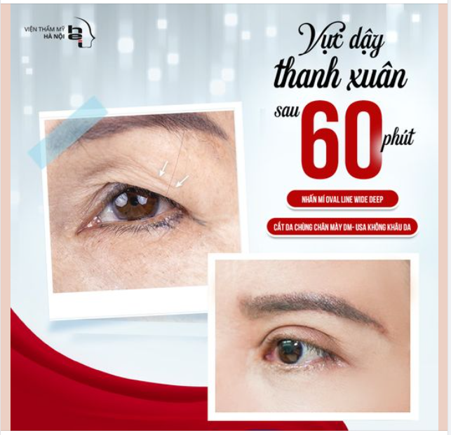 VỰC DẬY THANH XUÂN SAU 60P