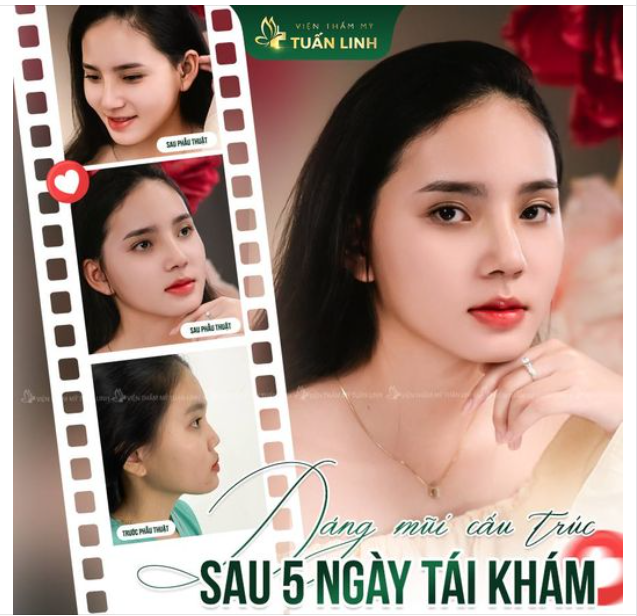 Tuấn Linh có gì mà sao khách đông thế ạ??? Thì đây...Có mũi xinh đây ạ!!