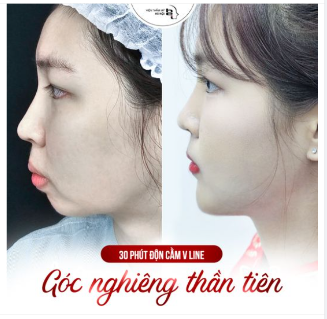 ĐỘN CẰM VLINE - GÓC NGHIÊNG THẦN TIÊN