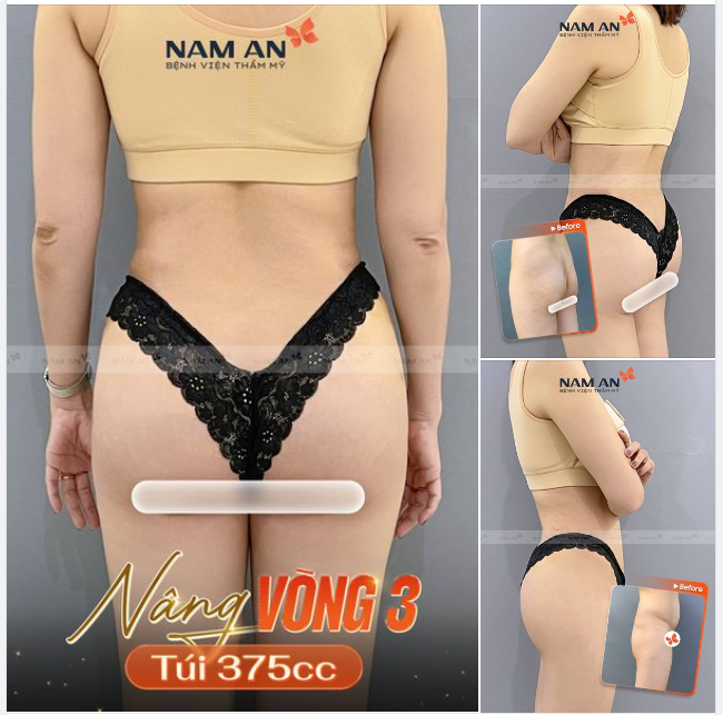 NÂNG MÔNG TÚI 375CC - SEXY HẾT CỠ