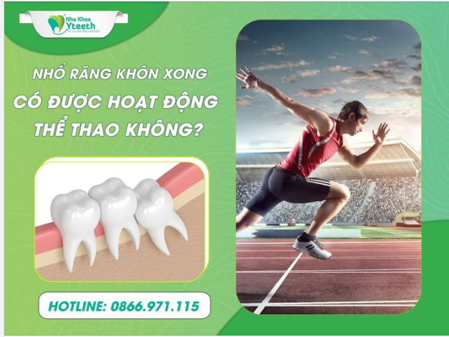 Nhổ răng khôn xong có được hoạt động thể thao?