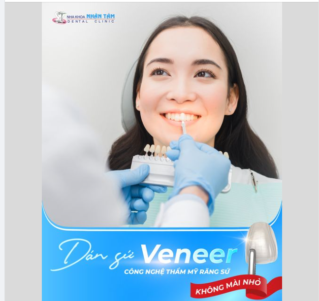 Dán sứ veneer - Công nghệ thẩm mỹ răng sứ hạn chế mài nhỏ