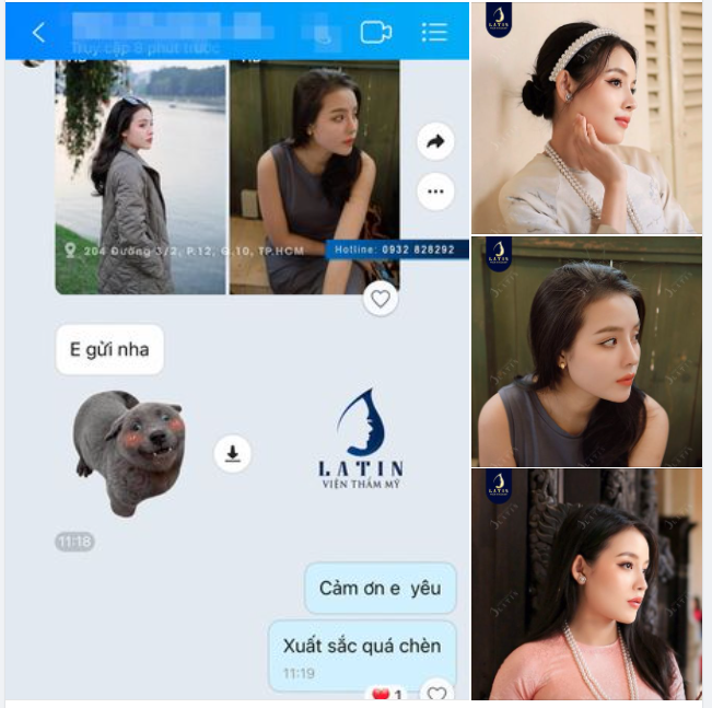Xinh quá xinh sau 2 năm sửa mũi tại Latin