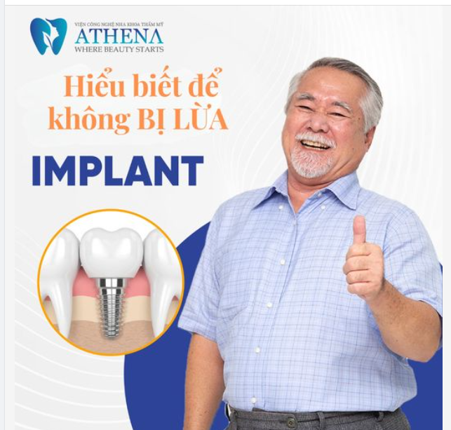 BẠN SẼ BỊ LỪA NẾU NHƯ KHÔNG BIẾT KIẾN THỨC TRỒNG RĂNG IMPLANT NÀY!