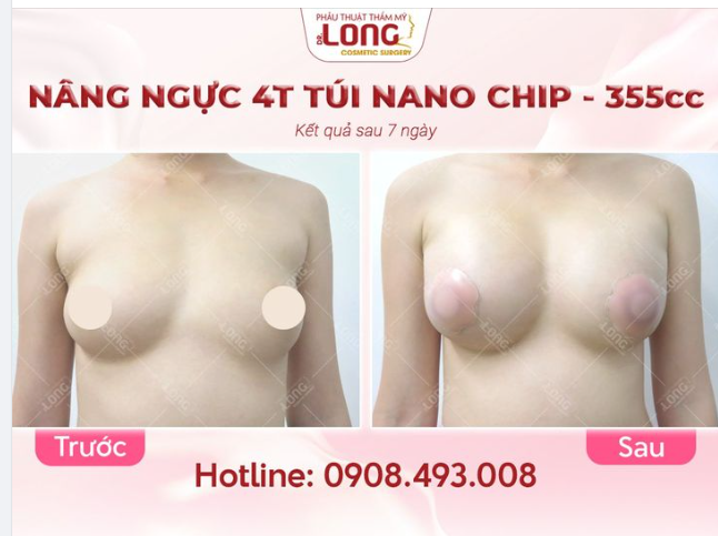 BỎ QUA CÁC LOẠI ÁO CON DÀY CỘM NÓNG BỨC TRONG HÈ NÀY
