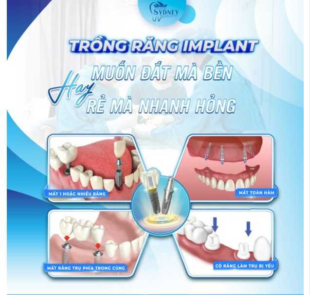 TRỒNG RĂNG IMPLANT - MUỐN ĐẮT MÀ BỀN HAY RẺ MÀ NHANH HỎNG