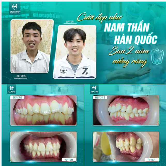 CƯỜI ĐẸP NHƯ NAM THẦN HÀN QUỐC SAU 2 NĂM NIỀNG
