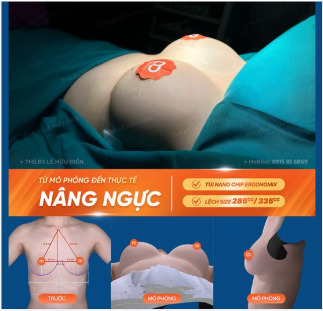 TỪ MÔ PHỎNG ĐẾN THỰC TẾ