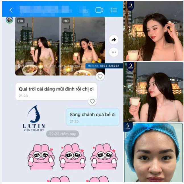 Sự khác biệt đến từ một dáng mũi mới