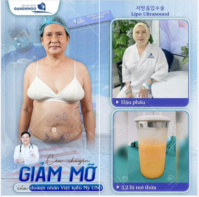 LÀM ĐẸP CHƯA BAO GIỜ LÀ QUÁ MUỘN! Câu chuyên giảm mỡ của doang nhân xứ cờ hoa