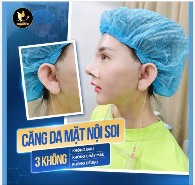 CĂNG DA MẶT NỘI SOI - TÌM LẠI 10 NĂM THANH XUÂN CHỈ SAU 60 PHÚT
