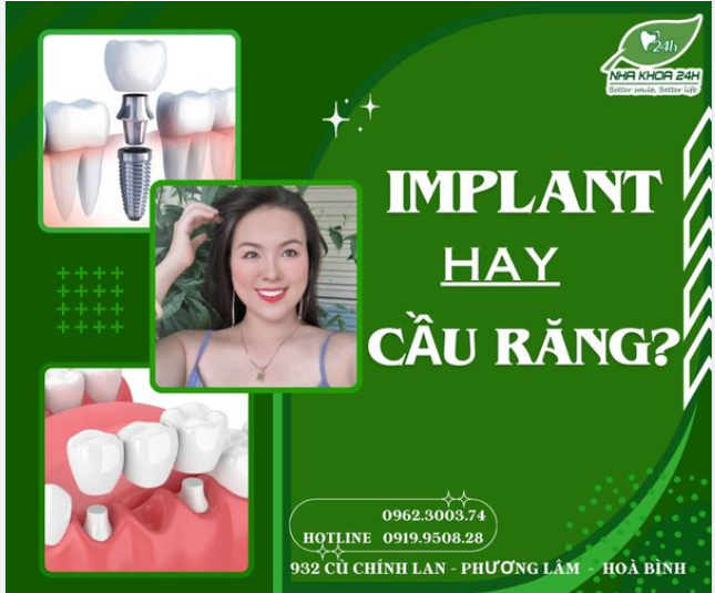 Khi mất răng, nên làm cầu răng sứ hay cấy Implant? 