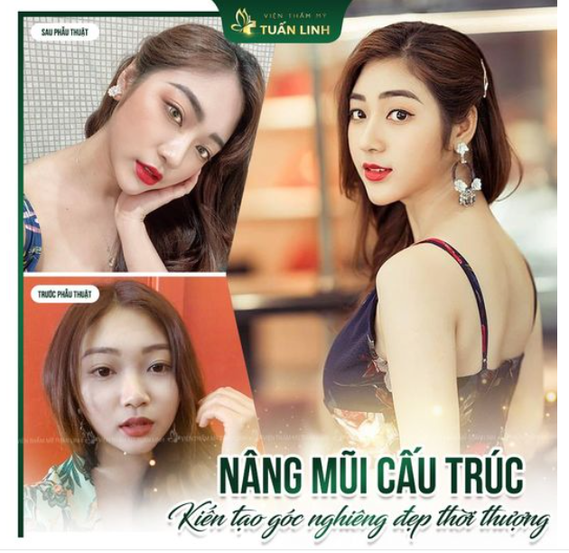 Đẹp sang chảnh cùng dáng mũi thời thượng!!