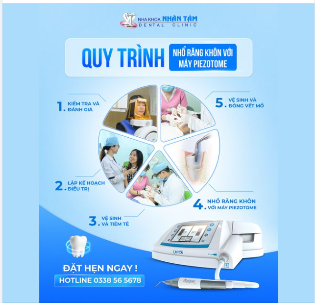 QUY TRÌNH NHỔ RĂNG KHÔN VỚI MÁY PIEZOTOME
