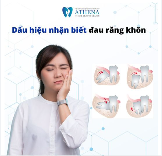 DẤU HIỆU NHẬN BIẾT ĐAU RĂNG KHÔN, CHỚ BỎ QUA!!!