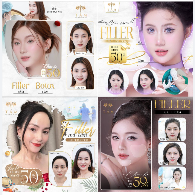 CẢ NHÀ CÙNG NGẮM SỰ THAY ĐỔI SAU KHI LÀM FILLER - BOTOX CỦA KHÁCH YÊU Ở TẤM NHÉ!