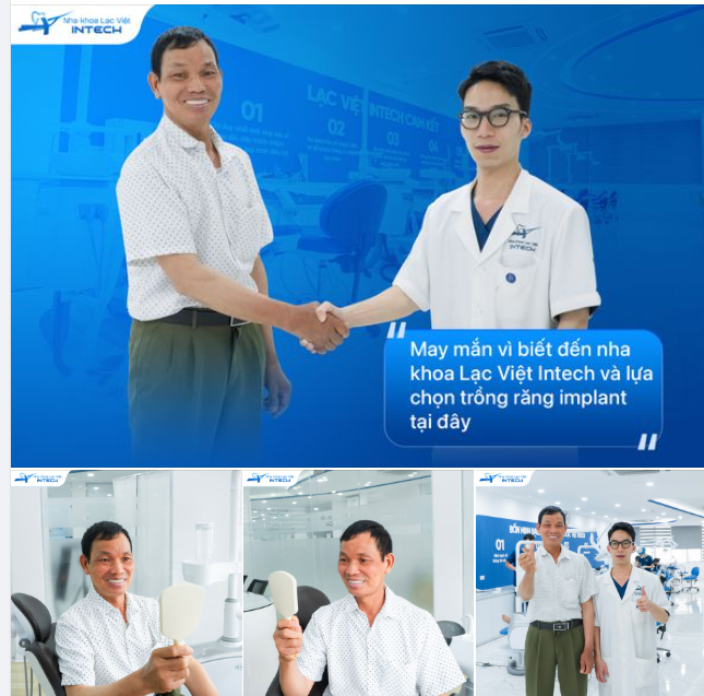 10 NĂM SỐNG TRONG NỖI ÁM ẢNH CẦU RĂNG SỨ, HIỆN TẠI MÃN NGUYỆN SAU TRỒNG RĂNG IMPLANT