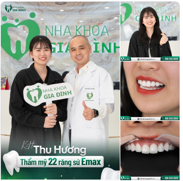 "LỘT XÁC" NỤ CƯỜI VỚI RĂNG SỨ CAO CẤP TẠI NHA KHOA GIA ĐÌNH