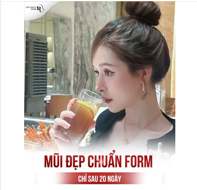"Sở Hữu Góc Nghiêng Vạn Người Mê" chỉ sau 45' thực hiện nâng mũi Bella Silk 5S