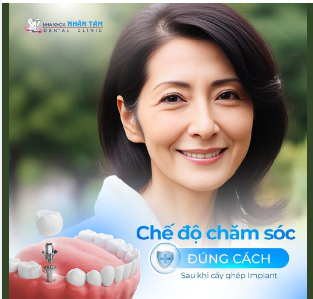 Chế độ chăm sóc đúng cách sau khi cấy ghép Implant