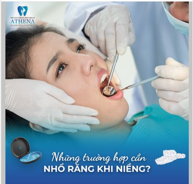 NHỮNG TRƯỜNG HỢP CẦN NHỔ RĂNG KHI NIỀNG?