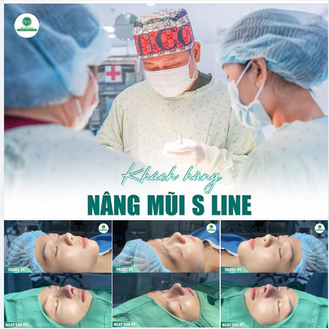 CUỐI NGÀY CÙNG CHIẾC MŨI S LINE CỰC PHẨM