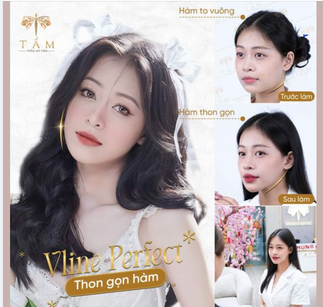 1 LIỆU TRÌNH DUY NHẤT - CÓ NGAY KHUÔN HÀM VẠN NGƯỜI MÊ
