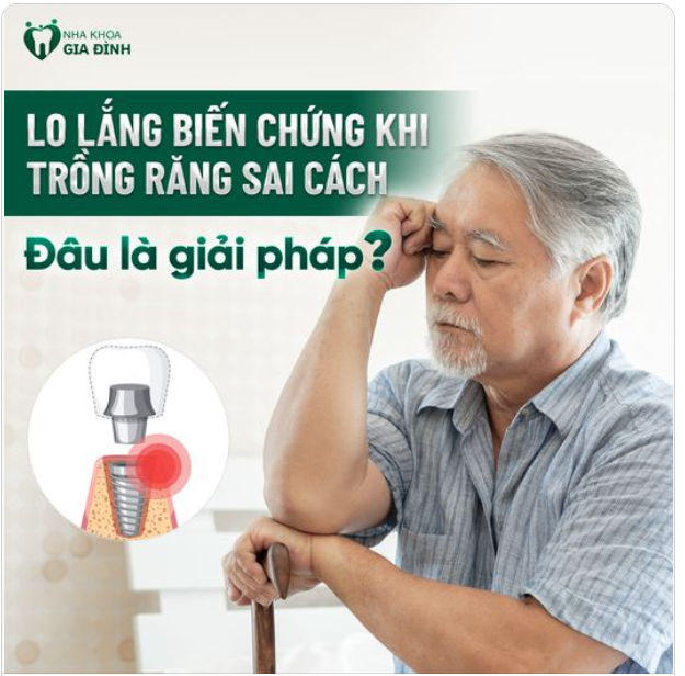 LO LẮNG NHỮNG BIẾN CHỨNG KHI TRỒNG RĂNG IMPLANT SAI CÁCH. ĐÂU LÀ GIẢI PHÁP?