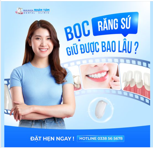 Bọc răng sứ giữ được bao lâu?