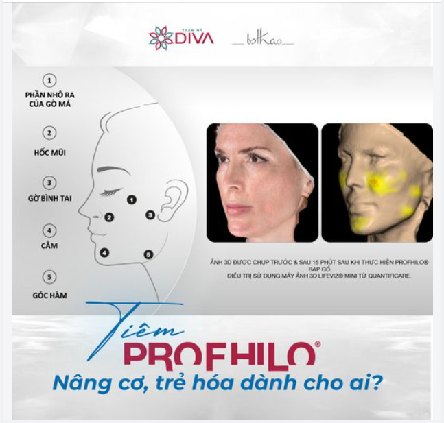 PROFHILO NÂNG CƠ, TRẺ HÓA DÀNH CHO AI?