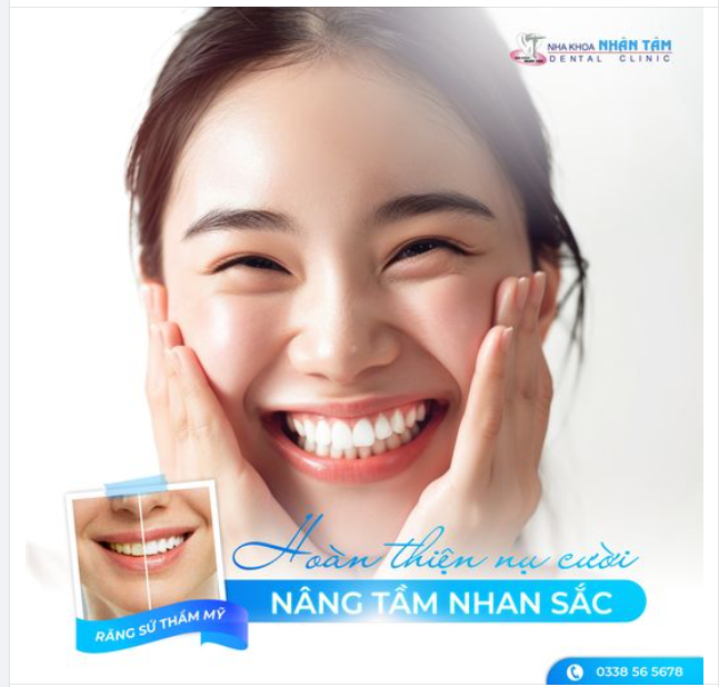 Răng Sứ Thẩm Mỹ - Hoàn Thiện Nụ Cười, Nâng Tầm Nhan Sắc