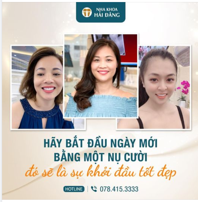 Răng sứ thẩm mỹ là phương pháp được nhiều khách hàng lựa chọn để sở hữu một nụ cười tự tin, thu hút mọi ánh nhìn. Vậy, răng sứ như thế nào là đẹp?