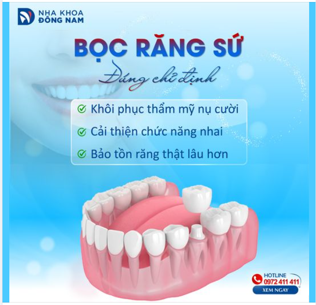 BỌC RĂNG SỨ ĐÚNG CHỈ ĐỊNH – HÀNH TRÌNH CHO SỨC KHỎE RĂNG MIỆNG BỀN VỮNG