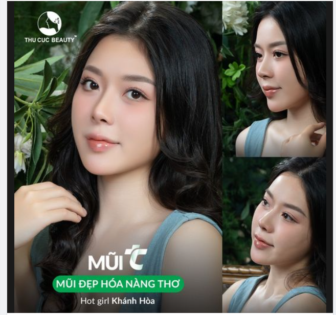 Hóa nàng thơ sau nâng mũi cùng Hot girl Khánh Hòa