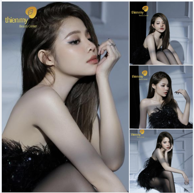 Dáng mũi sau 6 năm. Tại PKCK Thiện Mỹ khi thực hiện NÂNG MŨI bạn sẽ được: