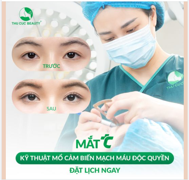Mắt TC - Kỹ thuật mổ cảm biến mạch máu độc quyền