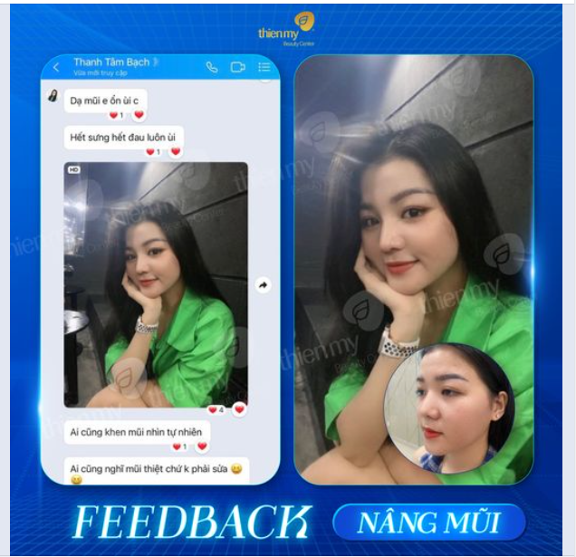 PKCK Thiện Mỹ luôn tự hào vì đã mang lại sự tự tin và hài lòng cho nhiều khách hàng sau khi thực hiện dịch vụ nâng mũi.