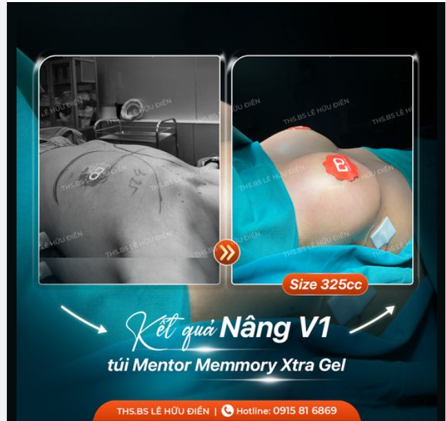 "BỨC TƯỜNG" VÀ "ĐỒI NÚI" CHỈ CÁCH NHAU 60 PHÚT THỰC HIỆN