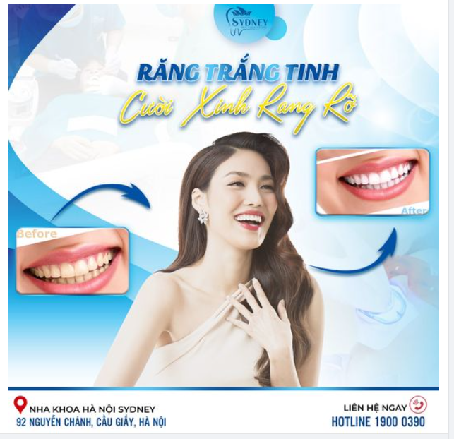 RĂNG TRẮNG TINH - CƯỜI XINH RẠNG RỠ