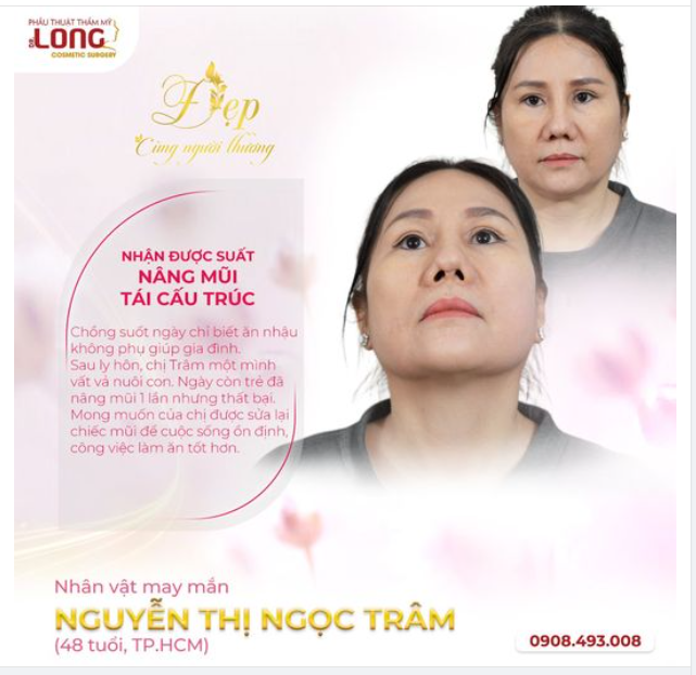 ️️Chị: Nguyễn Thị Ngọc Trâm (48 tuổi - TP.HCM) đã may mắn trở thành khách hàng nhận được suất PTTM nâng mũi tái cấu trúc miễn phí của chương trình “ĐẸP CÙNG NGƯỜI THƯƠNG”.
