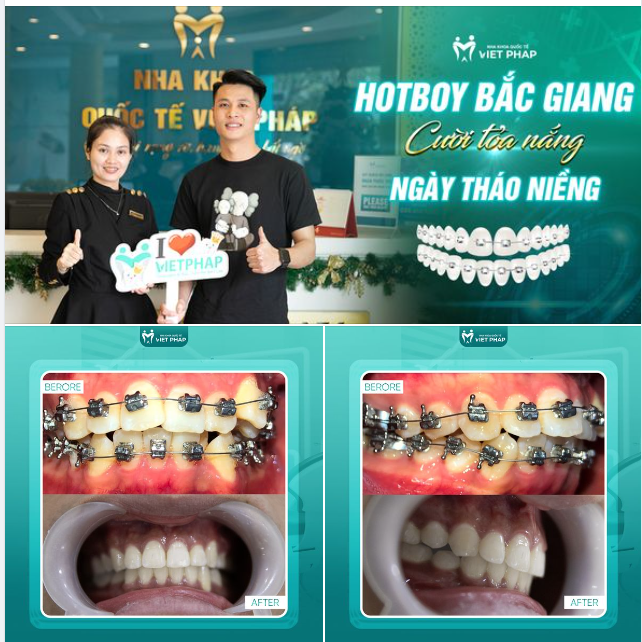 HOTBOY BẮC GIANG CƯỜI TOẢ NẮNG NGÀY THÁO NIỀNG