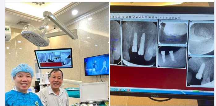 CÁC QUY TRÌNH CẤY GHÉP IMPLANT AN TOÀN- HIỆU QUẢ CHO NGƯỜI CAO TUỔI