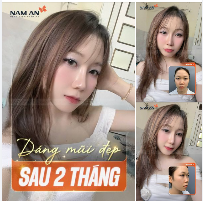 BẮT TRỌN ÁNH NHÌN VỚI DÁNG MŨI 2 THÁNG