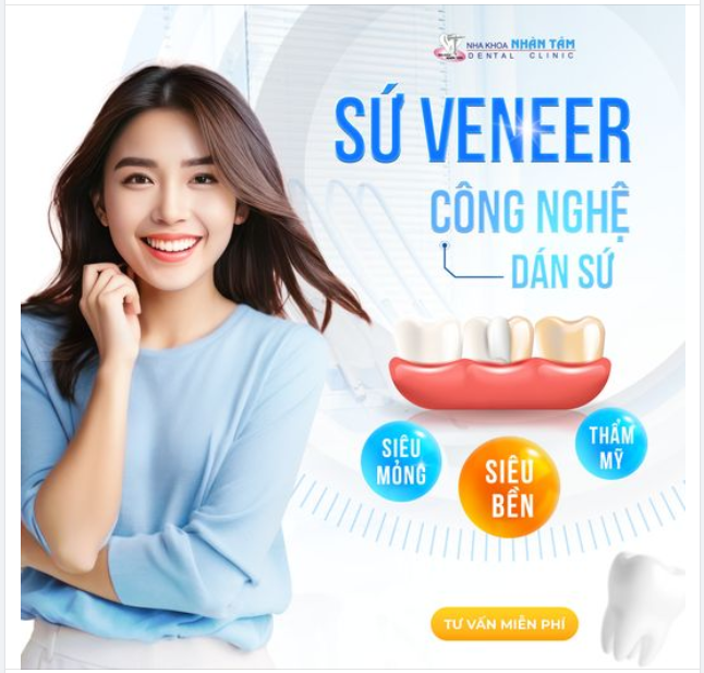 SỨ VENEER - CÔNG NGHỆ DÁN SỨ SIÊU MỎNG, SIÊU BỀN