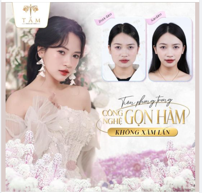 CHỈ 1 LIỆU TRÌNH 45 PHÚT - THAY ĐỔI KHÔNG NHẬN RA CHÍNH MÌNH!!
