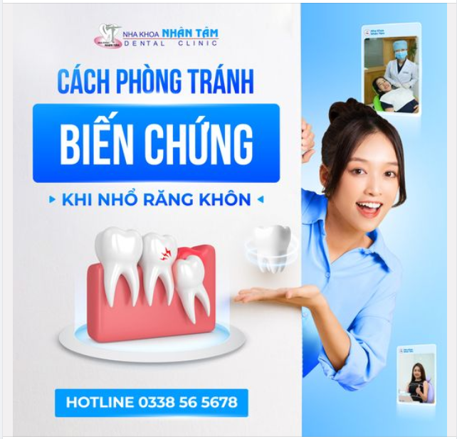 Cách Phòng Tránh Biến Chứng Nhổ Răng Khôn