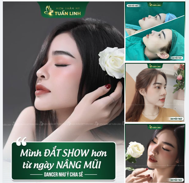 Siêu phẩm Mũi cấu trúc phong thủy cho cô nàng Dancer chạy show không kịp là đây!!!